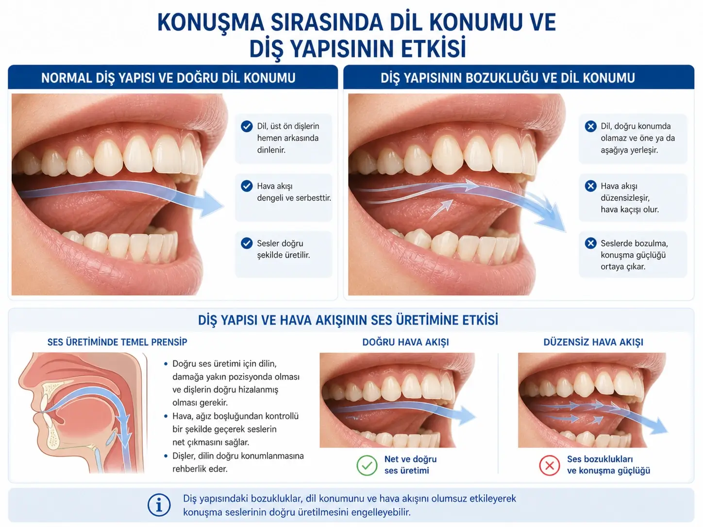 Diş diziliminin konuşma ve ses oluşumuna etkisi